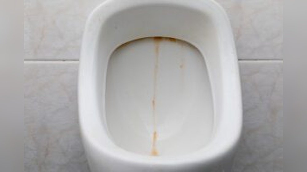 How To Remove Urine Crystals From Toilets