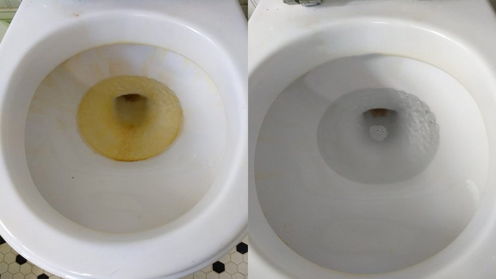What Causes Yellow Stains In Toilet Bowl
