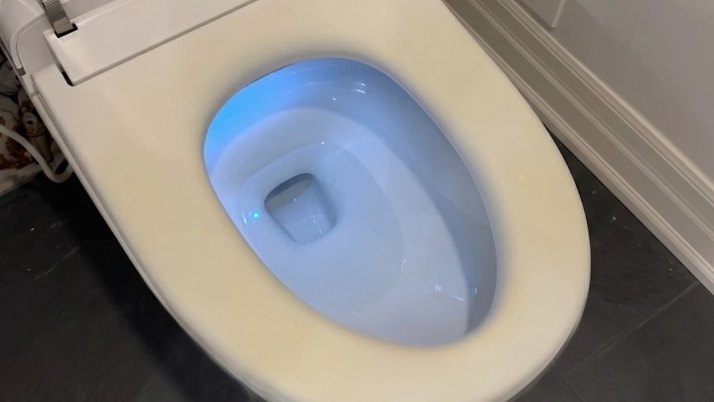 Why Does Toilet Seat Turn Yellow