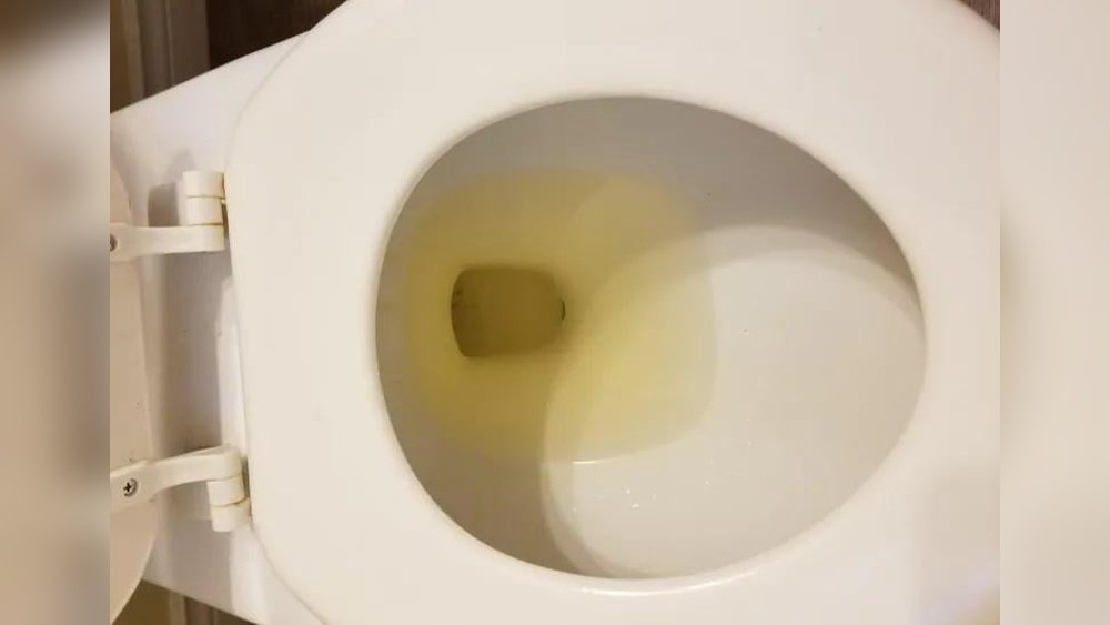Why Is My Toilet Water Yellow